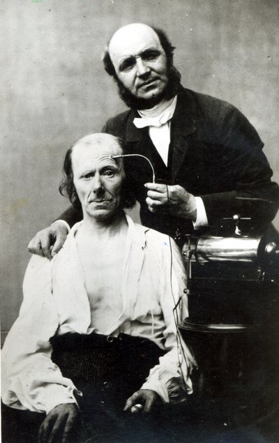 Duchenne de Boulogne with a patient, 1862 by French Photographer